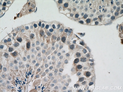 [13886-1-AP-20UL] SIAH1 Polyclonal antibody