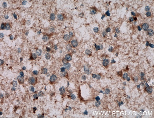 [13888-1-AP-150UL] NKIAMRE Polyclonal antibody