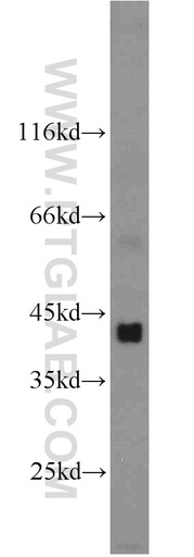 [13889-1-AP-20UL] DHH Polyclonal antibody