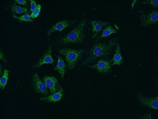 [13893-1-AP-150UL] Synaptojanin 2 Polyclonal antibody
