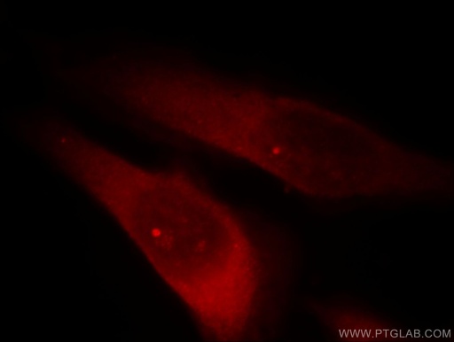 [13894-1-AP-150UL] RABGAP1L Polyclonal antibody