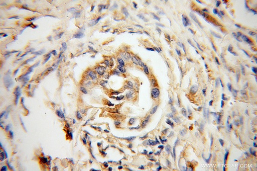 [13900-1-AP-20UL] DHDH Polyclonal antibody