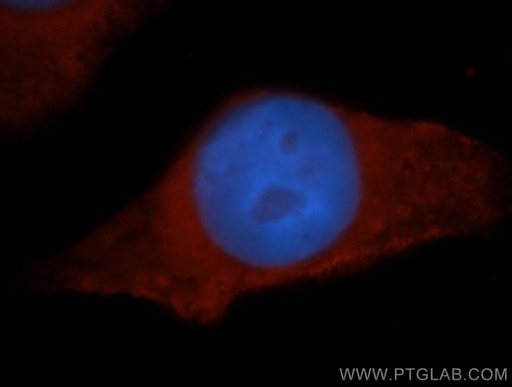[13901-1-AP-150UL] HPS5 Polyclonal antibody