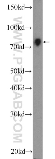 [13906-1-AP-150UL] NR1D2 Polyclonal antibody