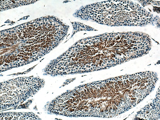 [13907-1-AP-150UL] AKAP3 Polyclonal antibody