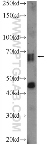 [13908-1-AP-150UL] SLAIN2 Polyclonal antibody