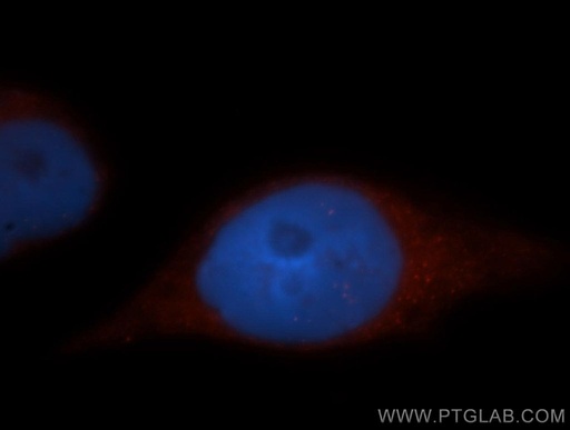 [13911-1-AP-20UL] ADAP1 Polyclonal antibody