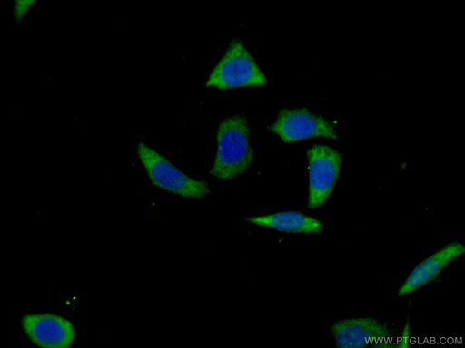 [13915-1-AP-150UL] SPAG8 Polyclonal antibody