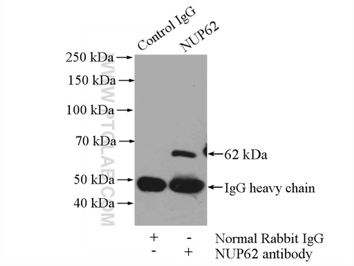 [13916-1-AP-150UL] NUP62 Polyclonal antibody