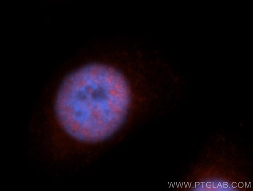 [13918-1-AP-20UL] RBM17 Polyclonal antibody