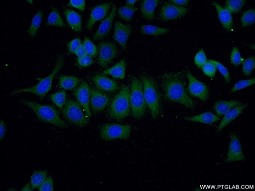 [13919-1-AP-20UL] VILIP-1 Polyclonal antibody