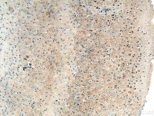 [13920-1-AP-20UL] SLC6A11 Polyclonal antibody