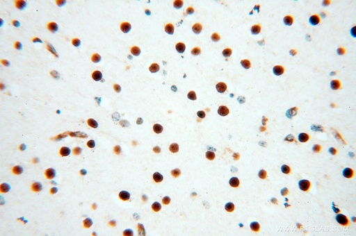 [13921-1-AP-150UL] NKX2-5 Polyclonal antibody