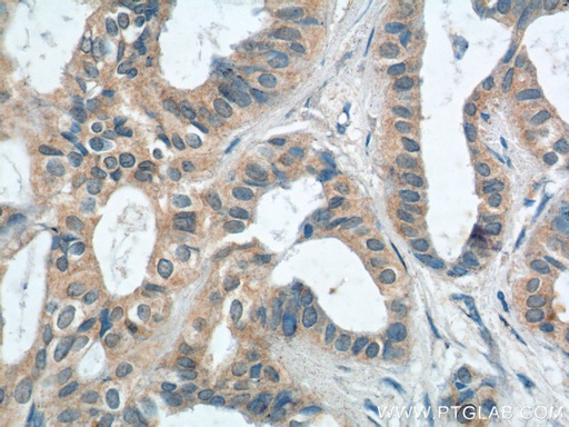 [13922-1-AP-20UL] PTPRE Polyclonal antibody