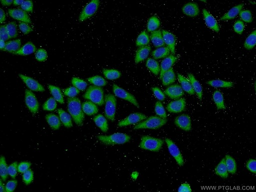 [13924-1-AP-20UL] MTM1 Polyclonal antibody