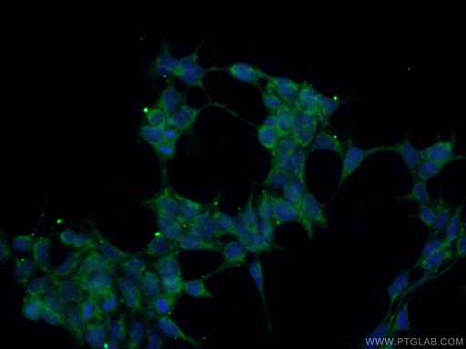 [13927-1-AP-20UL] GNAQ Polyclonal antibody