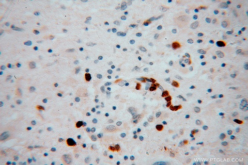 [13930-1-AP-150UL] KIF3A Polyclonal antibody