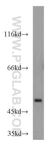 [13932-1-AP-150UL] TSPYL1 Polyclonal antibody