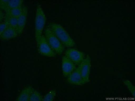 [13934-1-AP-150UL] FBXL14 Polyclonal antibody
