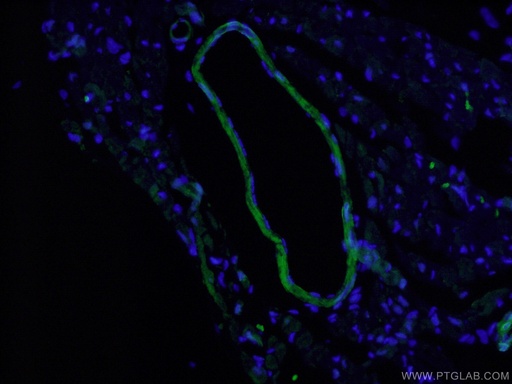 [13938-1-AP-20UL] Calponin Polyclonal antibody