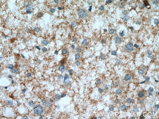[13942-1-AP-150UL] PGM2L1 Polyclonal antibody