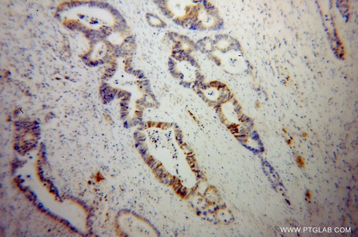 [13943-1-AP-20UL] SCNN1G Polyclonal antibody