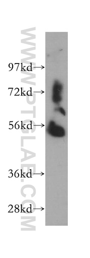 [13944-1-AP-20UL] WARS2 Polyclonal antibody