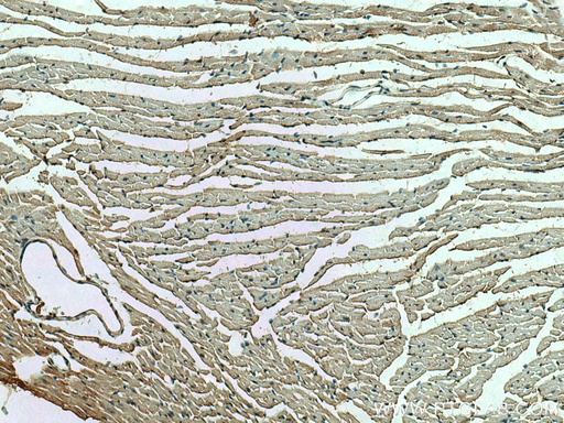 [13945-1-AP-150UL] RHOBTB3 Polyclonal antibody