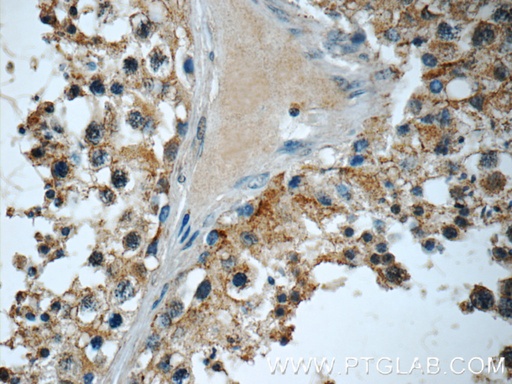[13946-1-AP-150UL] EMB Polyclonal antibody