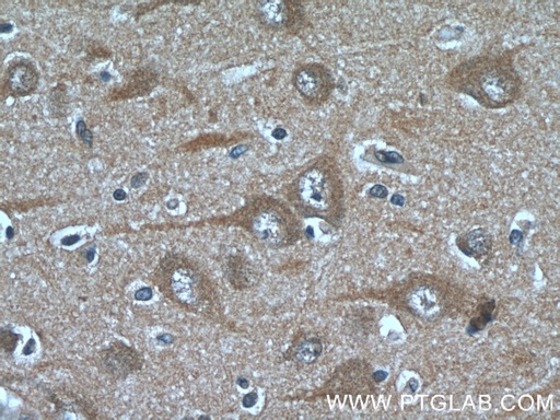 [13948-1-AP-150UL] FAM19A5 Polyclonal antibody
