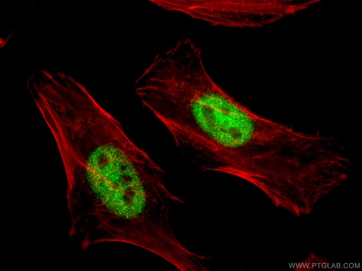 [13949-1-AP-20UL] MAPKAPK2 Polyclonal antibody