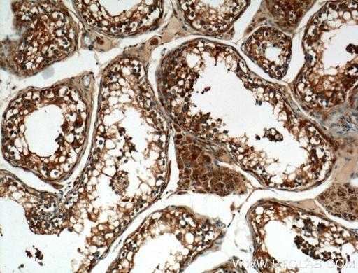 [13951-1-AP-150UL] ALDH1A2 Polyclonal antibody