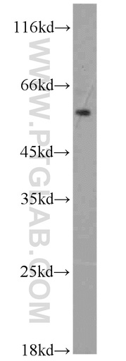 [13952-1-AP-20UL] ADAM2 Polyclonal antibody