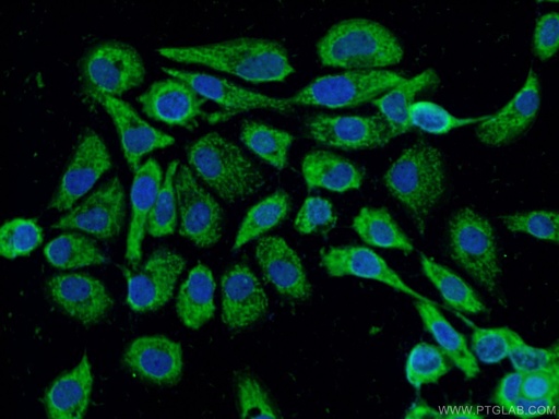 [13953-1-AP-150UL] PPFIBP2 Polyclonal antibody