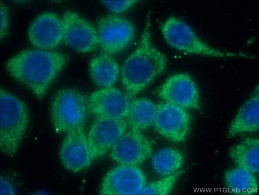 [13954-1-AP-150UL] Chk2 Polyclonal antibody