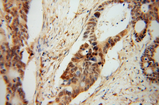 [13956-1-AP-20UL] PDE8A Polyclonal antibody