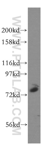 [13962-1-AP-150UL] GALNT7 Polyclonal antibody