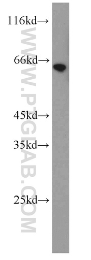 [13972-1-AP-150UL] Calicin Polyclonal antibody