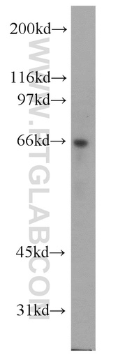 [13973-1-AP-150UL] ATE1 Polyclonal antibody