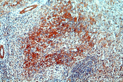 [13976-1-AP-150UL] CNNM3 Polyclonal antibody