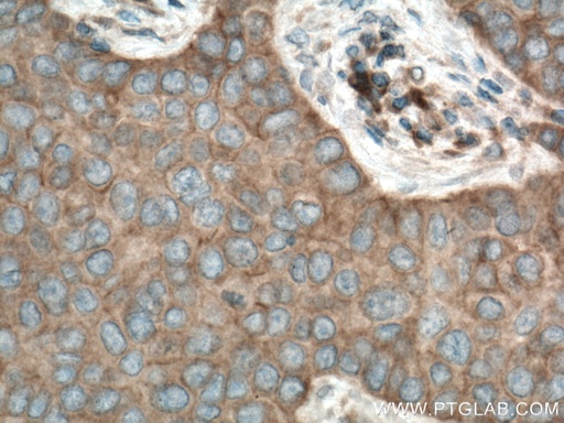 [13977-1-AP-20UL] YES1 Polyclonal antibody
