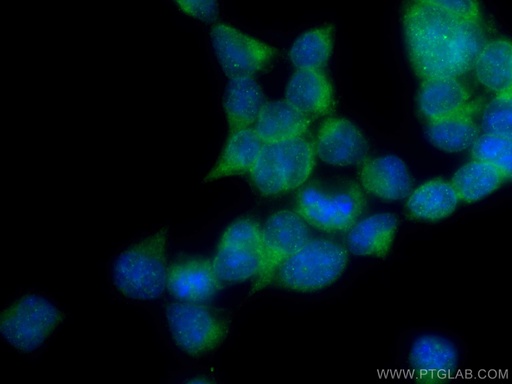 [13978-1-AP-20UL] SEC63 Polyclonal antibody