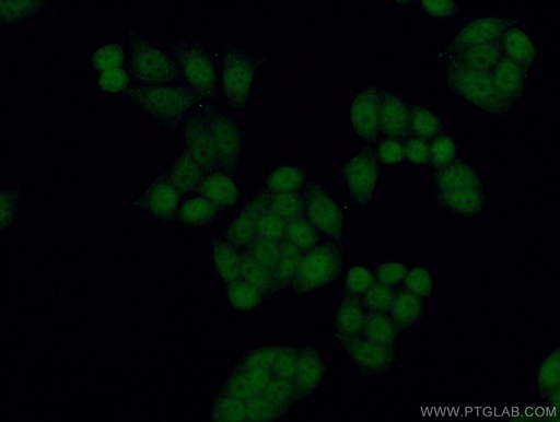 [13979-1-AP-20UL] TLK2 Polyclonal antibody
