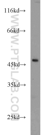[13986-1-AP-150UL] ANGPTL5 Polyclonal antibody