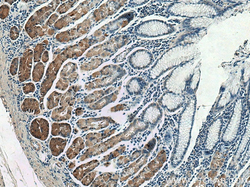 [13987-1-AP-20UL] TRAK1 Polyclonal antibody