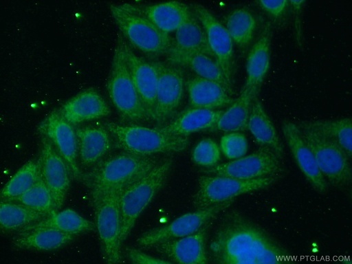 [13989-1-AP-20UL] ACSL1 Polyclonal antibody