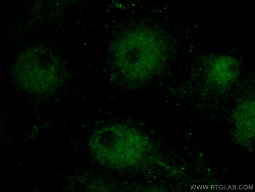 [13997-1-AP-20UL] Cryptochrome 2 Polyclonal antibody