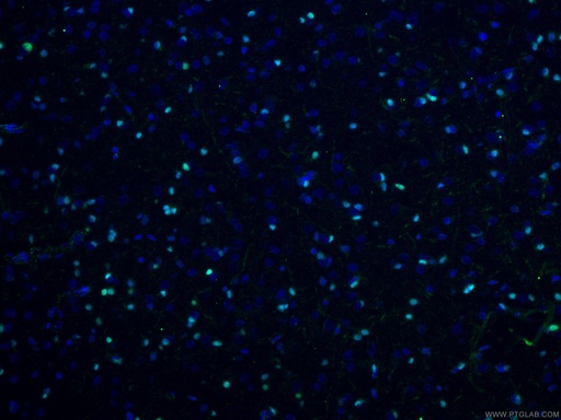 [13999-1-AP-150UL] OLIG2 Polyclonal antibody