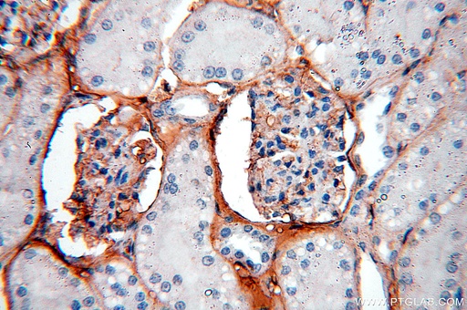 [14003-1-AP-150UL] IGSF11 Polyclonal antibody