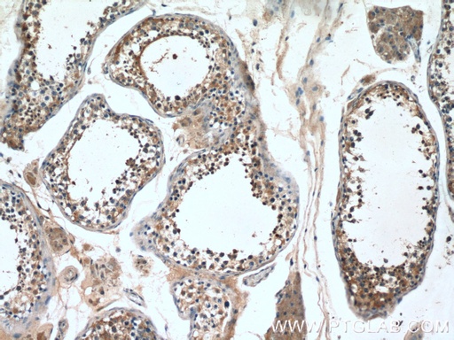 [14005-1-AP-20UL] PPP3R2 Polyclonal antibody